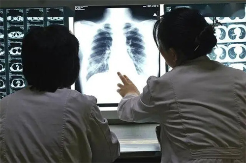 图片细节说明